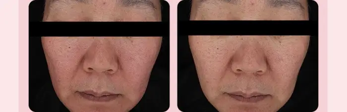 Product image 86